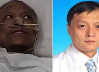 El antes y el después del doctor Yi Fan