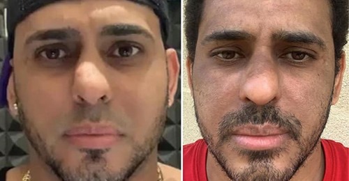 Artista urbano dominicano radicado en Italia muestra su cambio luego de padecer coronavirus