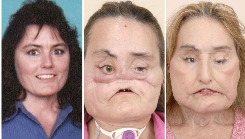 facialmueermuejsadios