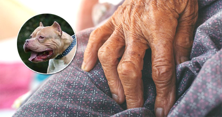 Un perro pitbull mata a su dueña de 84 años en su casa en Florida