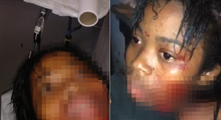 Joven se puso de pie y grito por ayuda; tras ser agredida