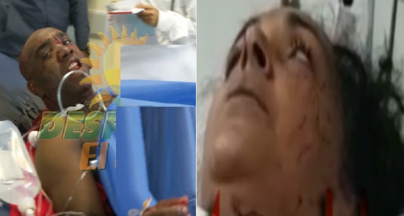 Mujer herida por un oficial de la Policía Nacional cuenta todo