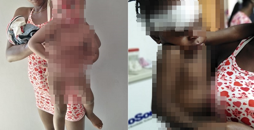 Hombre trataba de agredir a su mujer pero su hija recibió el golpe en la cabeza