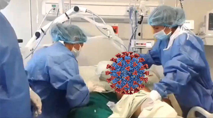 casodecobidelenPSKAMIRA