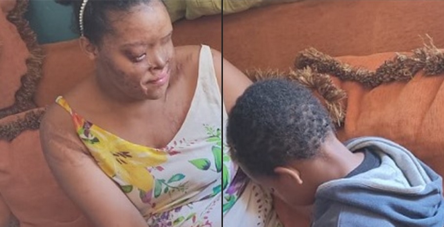 Arrojan ácido del diablo a una madre y su hijo en San Juan