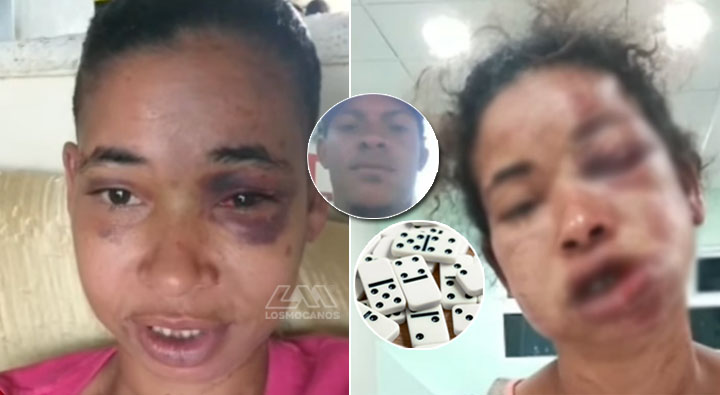 Mujer que fue agredida por su esposo clama justicia en Navarrete