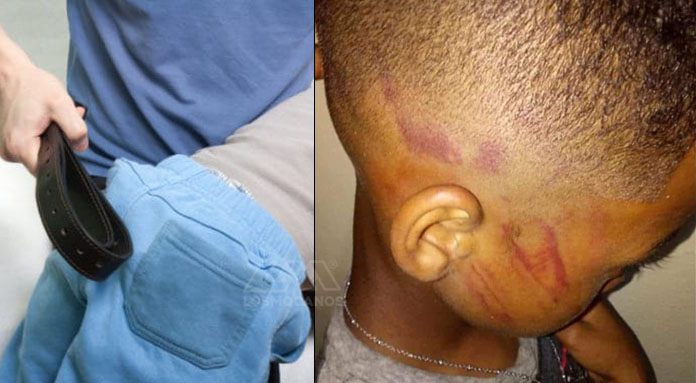 Acusan hombre de maltratar a su hijo de 8 años en Bonao