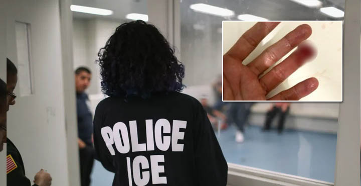 A prisión criollo inmigrante en el Bronx que mordió el dedo de un agente