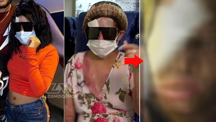 Yocairy Amarante muestra una foto de su rostro en redes sociales