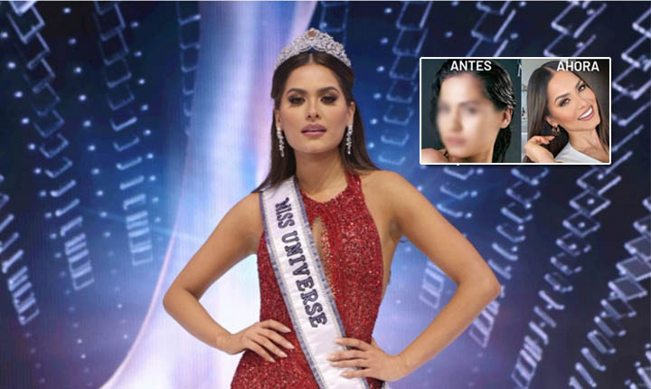 Salen a relucir las cirugías de Miss Universo; alegan que ganadora debe ser natural