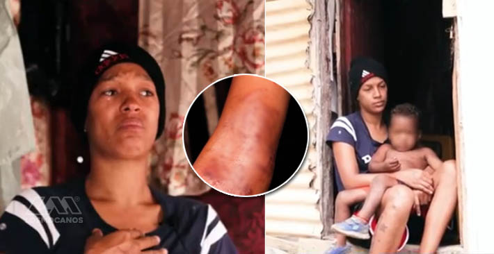 Joven madre con VIH clama por ayuda para ella y su niño