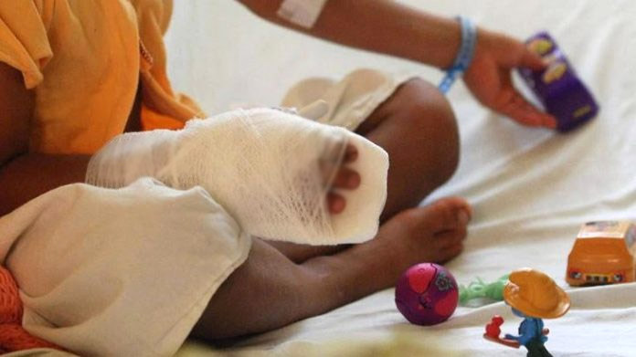 Mujer roció a su hijo con alcohol y le prendió fuego como castigo