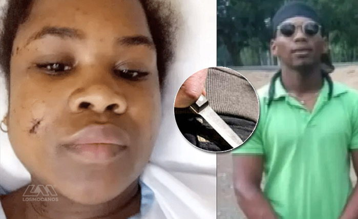 Mujer recibió 47 puñaladas de su expareja cuando dormía y sobrevive en Yamasá