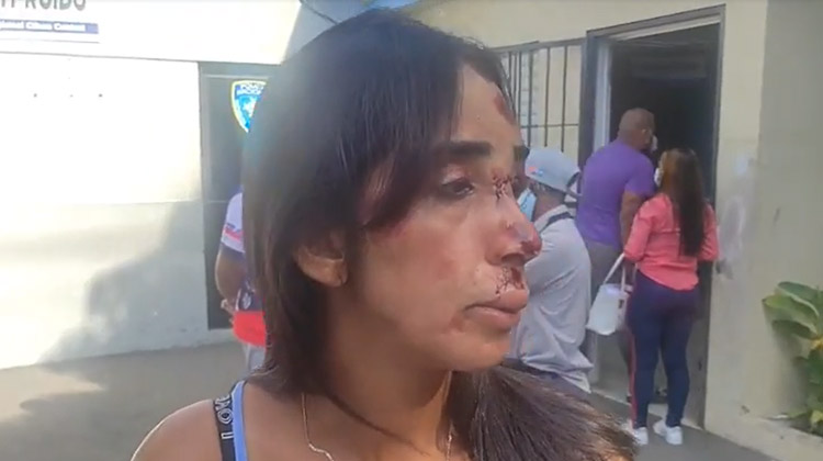Arrastran y asaltan a una mujer que sacó un palé en Santiago