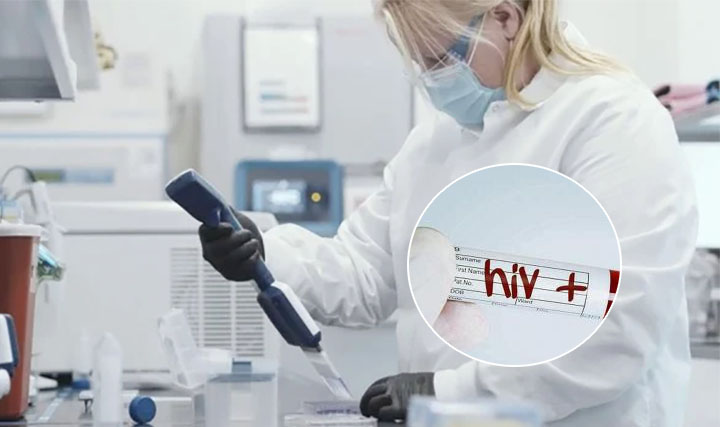 Científicos detectan una nueva variante del VIH más contagiosa