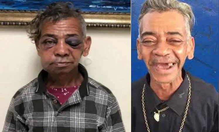 Hombres golpean a Fracatira para quitarle 400 pesos en Santiago