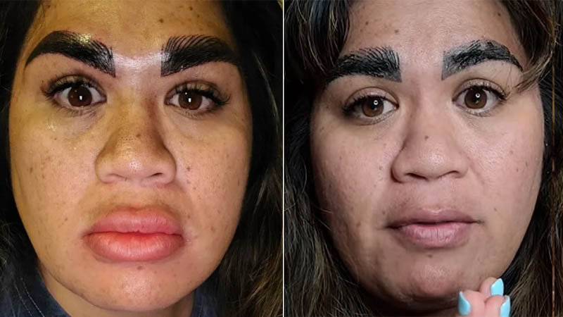 Mujer queda devastada tras realizarse proceso en las cejas 'Me han destrozado la cara'