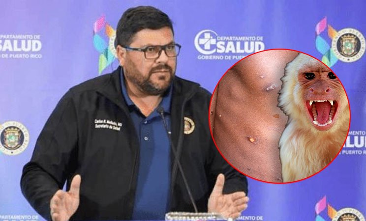 Puerto Rico confirma el primer caso de viruela del mono en la isla