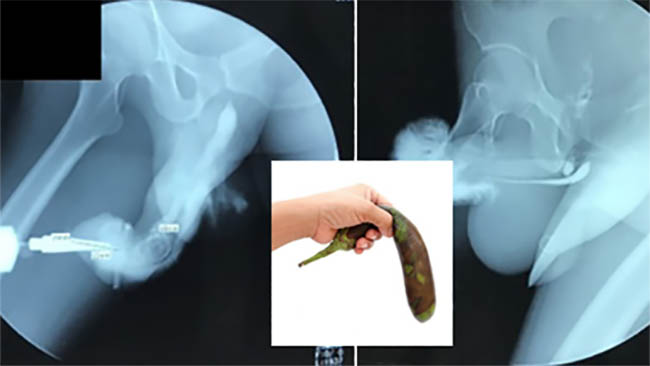 lapelsboamdmamor