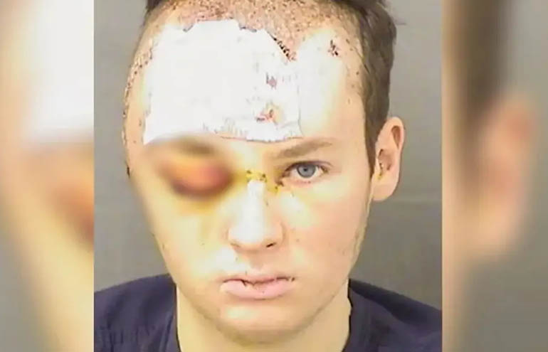 Hombre secuestra y viola a su terapeuta en Florida