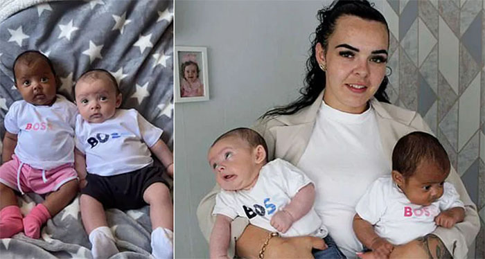 Mujer da a luz a dos mellidos con diferente color de piel