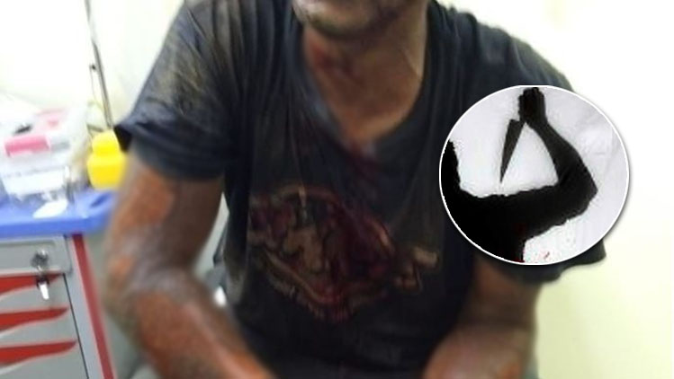 Hombre mata a puñaladas a su pareja y luego se prende fuego en Las Terrenas