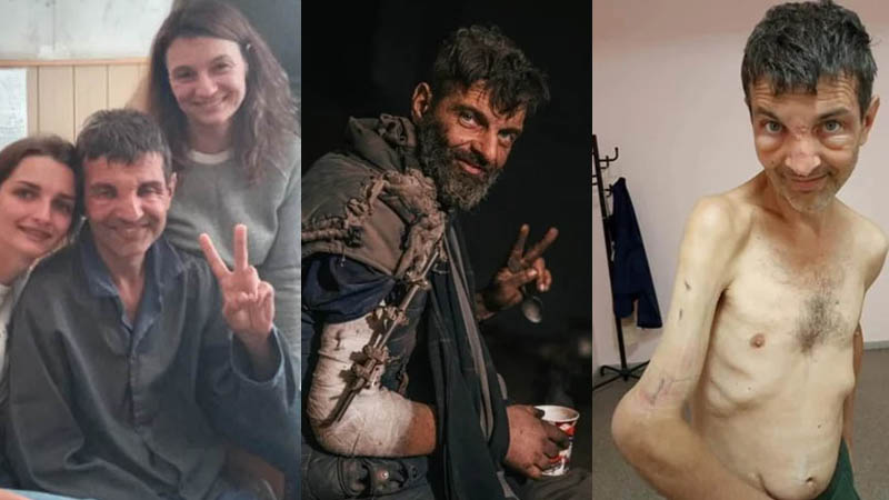 El antes y el después de uno de los soldados ucranianos liberado tras el intercambio de prisioneros con Rusia