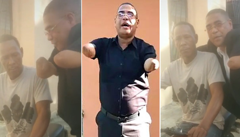 Hombre se encuentra con hermano de quién le cortó brazo y envía mensaje
