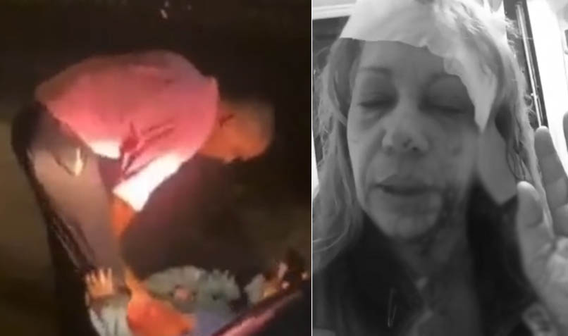 Policía busca hombre que golpeó y arrastró mujer 'Rafael, tú te va a joder'