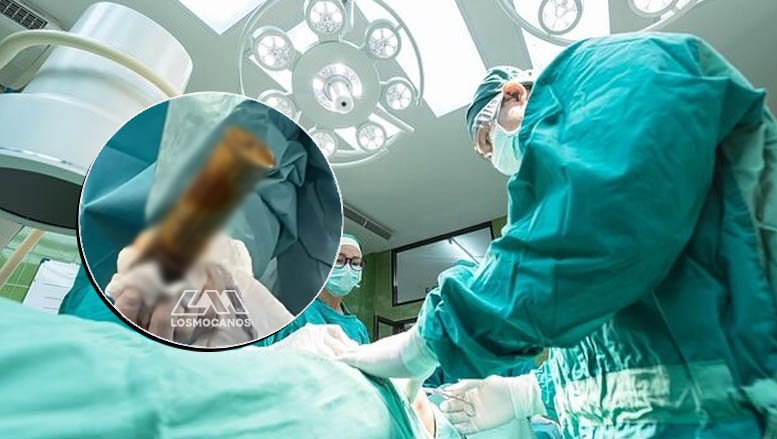 Hombre llega a hospital con proyectil en el ano y se arma tremendo caos