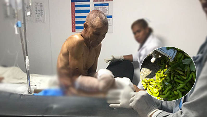 Dueño de finca le corta las manos a hombre al encontrarlo robando plátanos en SFM
