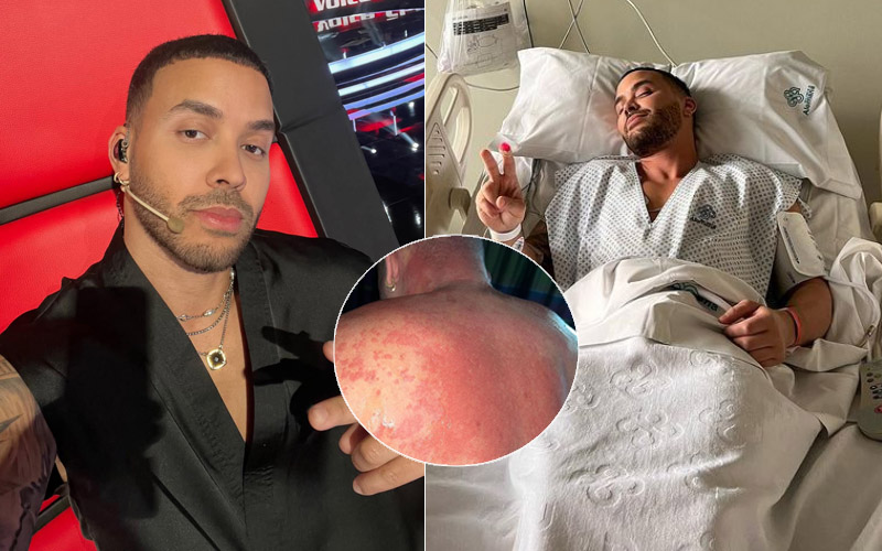 Cantante dominicano Prince Royce es hospitalizado en Chile por reacción alérgica