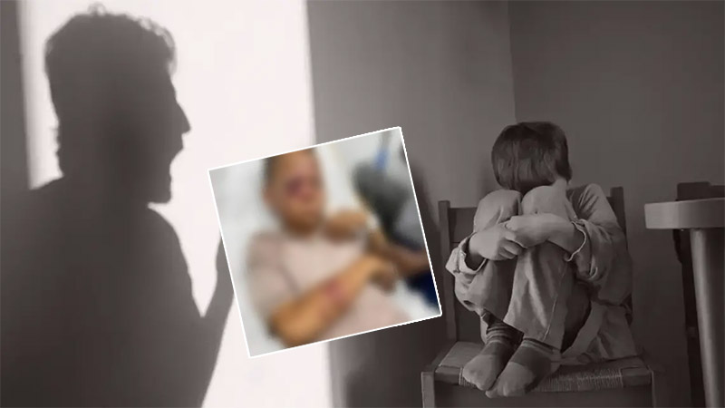 Ingresan niño en centro de salud tras ser golpeado brutalmente por su padre