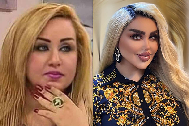 albadmamsairani