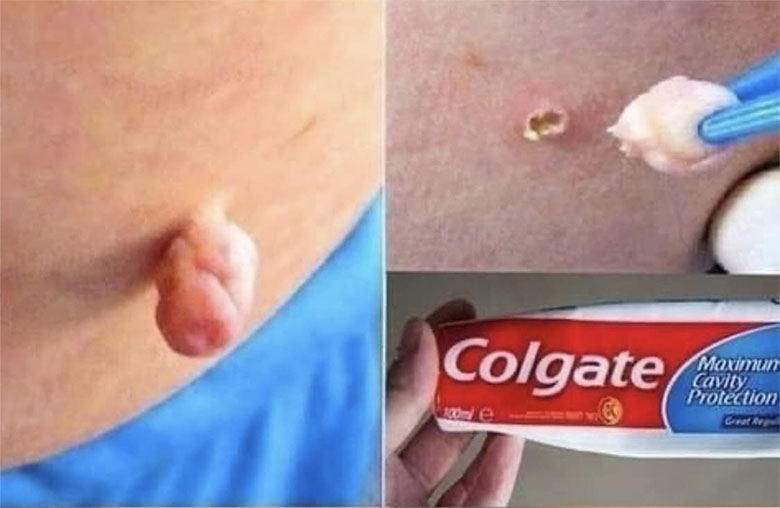 colgztecreemakmeste