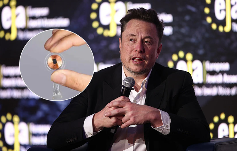 Elon Musk anuncia el implante del primer chip