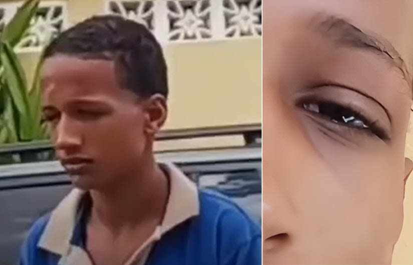 Madre denuncia que su hijo fue agredido en el centro Educativo Pedro Poveda