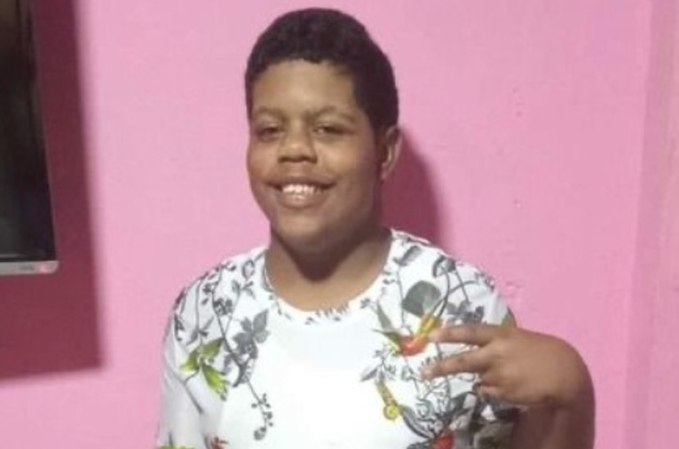 Muere el segundo menor del fuego en el carnaval de Salcedo