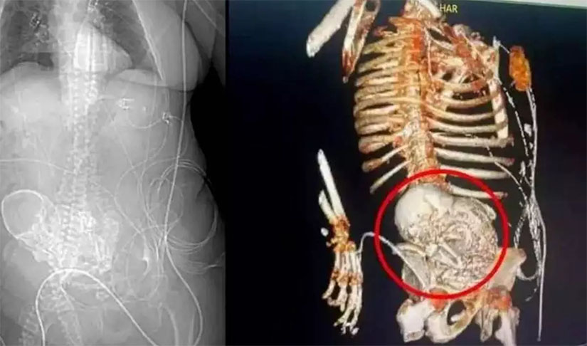 mujer que llevó en su vientre