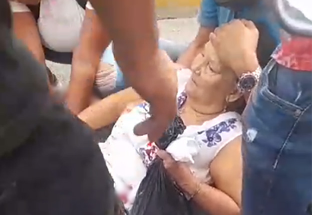 Mujer resultó lesionada al ser atropellada en SFM