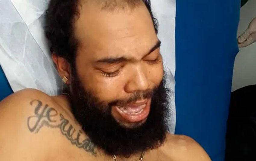 Hombre resulta herido durante incidente en SFM