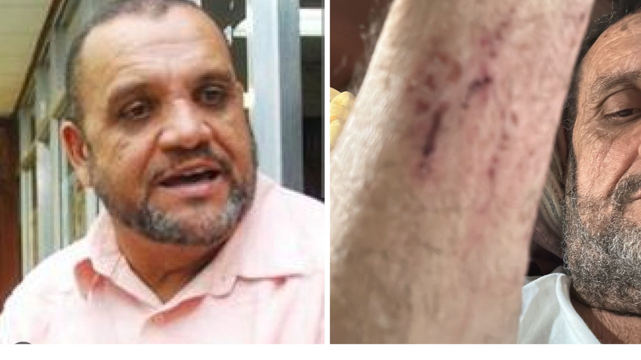 CMD exige a director de la Policía esclarecer agresión a doctor Hipólito Medina (El Morocho)