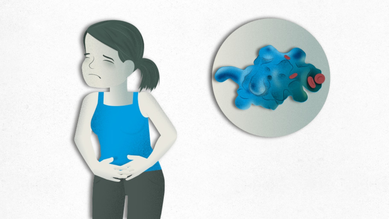 AMEBIASIS.jpg