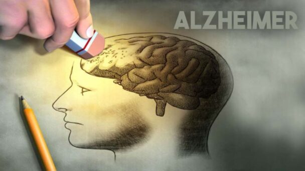 alzheimer-608x342.jpg