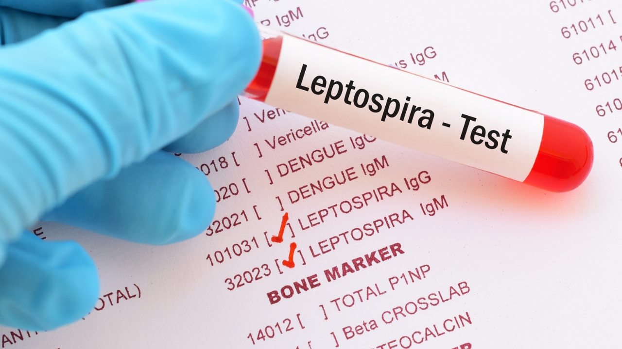 RD reporta 11 nuevos casos de leptospirosis