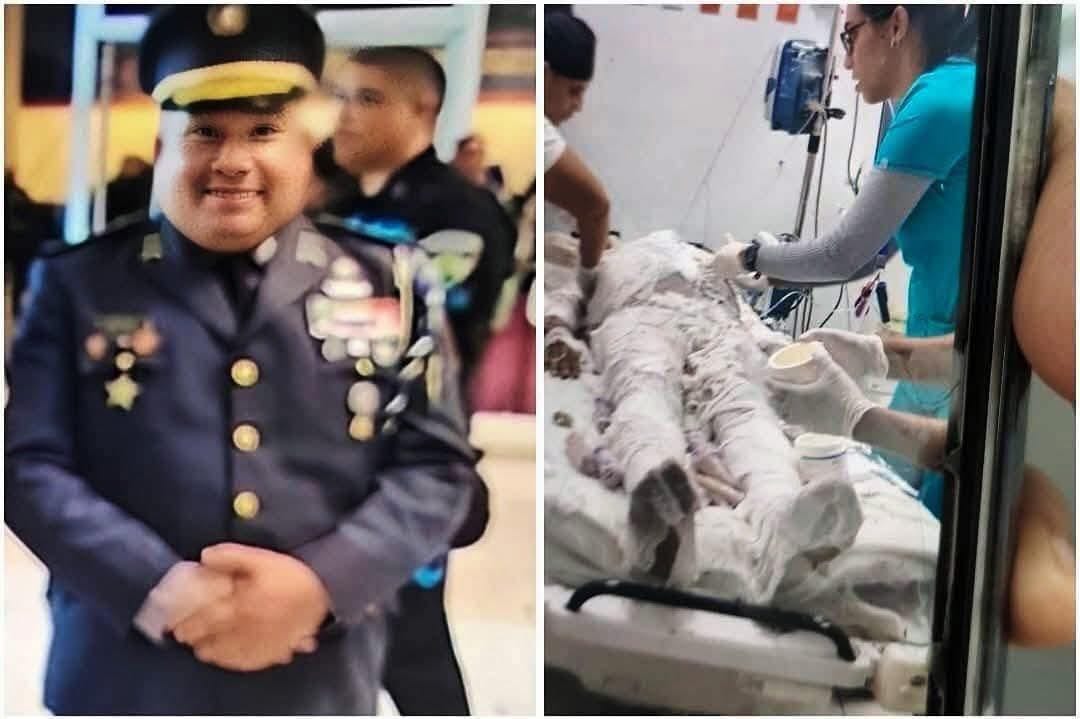 Fuego en comandancia deja encargado con quemaduras graves