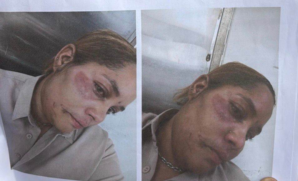 Mujer denuncia que raso de la PN la agredió brutalmente