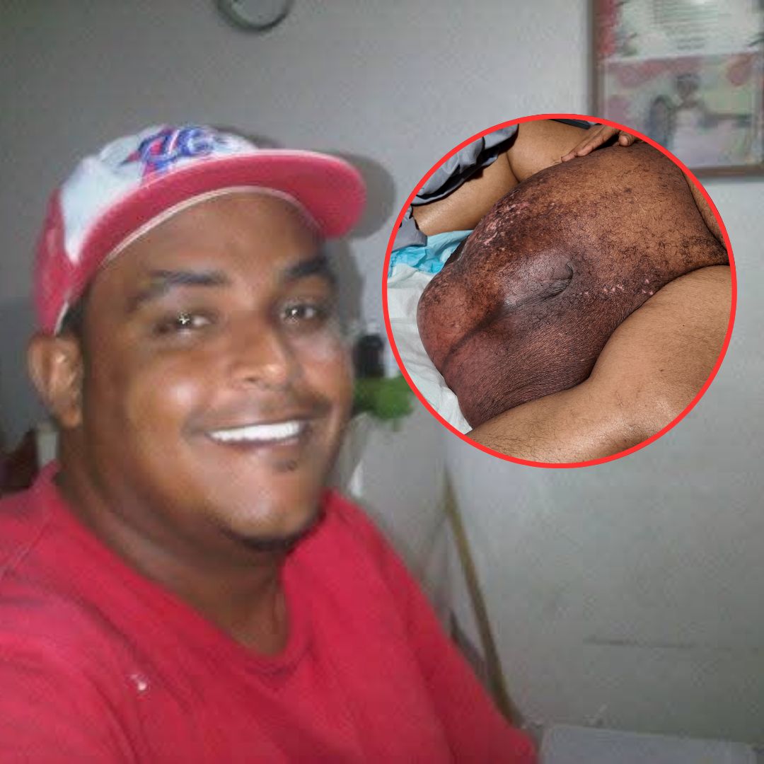 Tras reportaje de Bajo el Foco, ARS SeNaSa