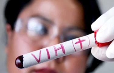 OPS desmiente que haya declarado una epidemia de VIH