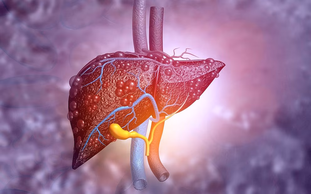 Análisis de sangre revela enfermedad hepática